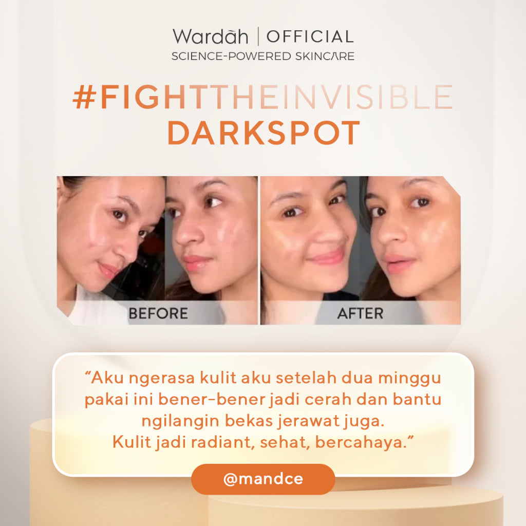 WARDAH 10% Vitamin C + Ferulic Acid Radiant Charge Serum 20 ml - Brightening Serum yang Menghilangkan dan Mencegah Noda Hitam Tak Terlihat untuk Kulit Cerah Lebih Lama - Skincare