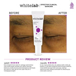 Whitelab Eye Cream - Krim Mata Atasi Kerutan, Garis Halus, Kantung Mata, dan Mata Panda dengan Peptide, Caffeine & Niacinamide [BPOM]
