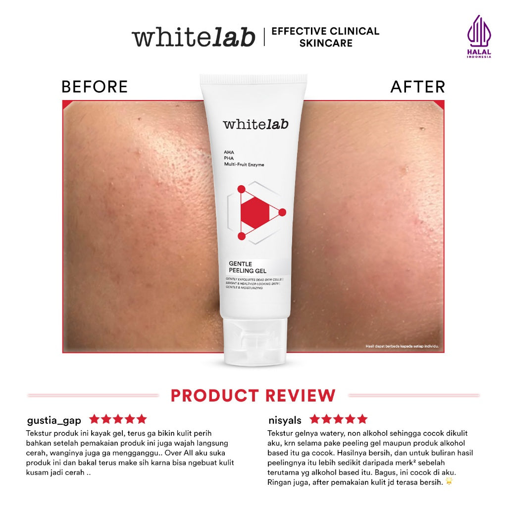 Whitelab Gentle Peeling Gel - Gel Pengangkat Sel Kulit Mati Kulit Normal, Kering, Sensitif untuk Kulit Halus, Lembap, dan Cerah dengan AHA PHA [BPOM]