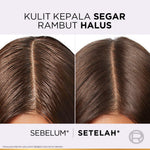 [BARU] L'Oreal Paris Hyaluron Pure 72H Purifying Shampoo - Perawatan Rambut Bebas Lepek dan Rambut Halus tahan hingga 72jam - Shampoo 280ml - Kulit Kepala Berminyak dan Rambut Kering