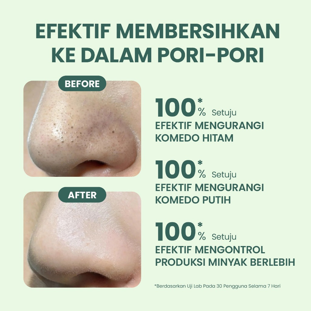 YOU AcnePlus Oil Control Clay Mask Masker Jerawat Masker Komedo Kulit Berminyak Bebas Jerawat