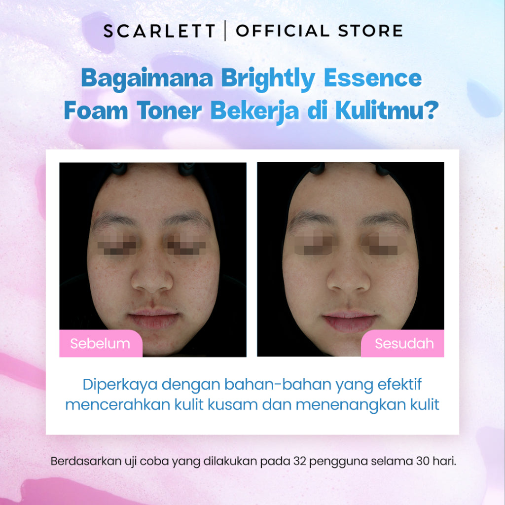 Scarlett Whitening Brightly Ever After Essence Foam Toner - Toner Wajah Kulit Sensitif untuk Mencerahkan Melembapkan dan Menghidrasi Wajah