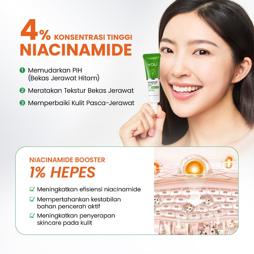 [NEW UPGRADED] YOU AcnePlus Spot Care Pro Serum Obat Totol Jerawat B5 Barrier Moisturizer Gel Obat Bekas Jerawat Kulit Sensitif Kulit Berjerawat [Hot Selling]