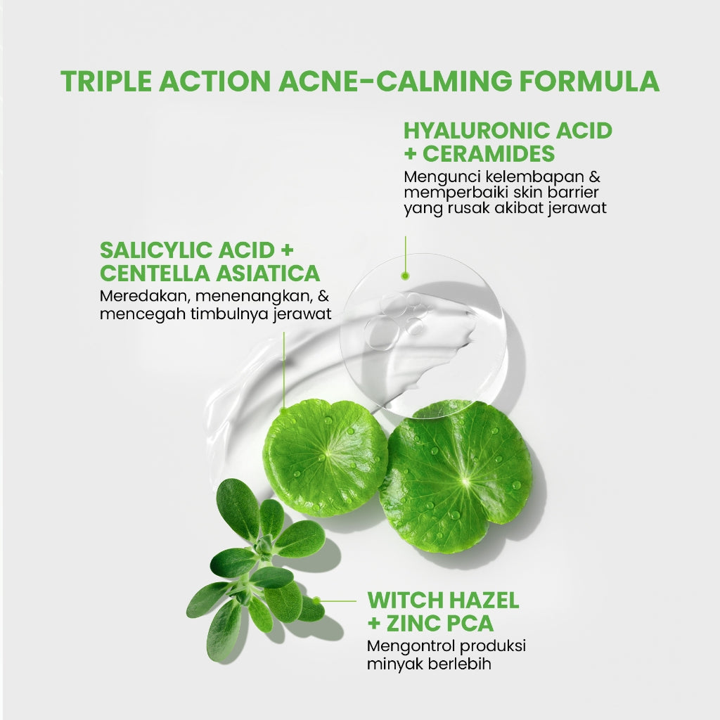 YOU Sunbrella Pro Acnecare Shield Sunscreen SPF 50+ PA++++ Acne Sunscreen Skincare  Collection Sunscreen Acne Prone Skin Melindungi dari Jerawat dan Sinar UV