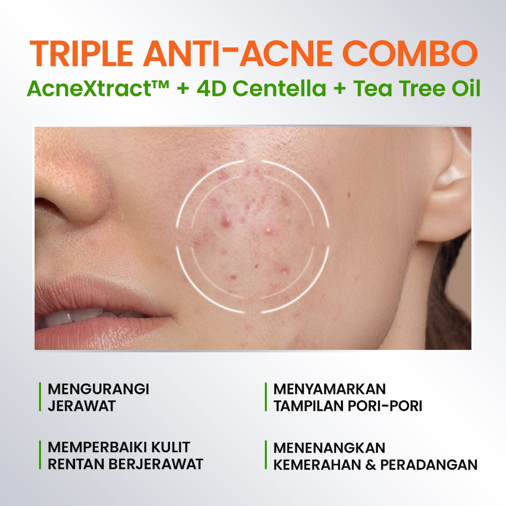 YOU AcnePlus Gentle Gel Cleanser Sabun Cuci Muka Jerawat Kulit Berminyak Berjerawat Salicylic Acid Face Wash