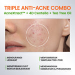 YOU AcnePlus Gentle Gel Cleanser Sabun Cuci Muka Jerawat Kulit Berminyak Berjerawat Salicylic Acid Face Wash