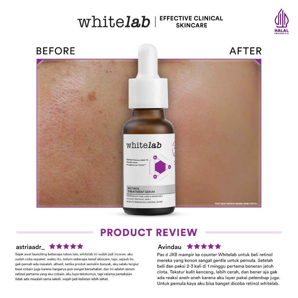 Whitelab Retinol Treatment Serum - Serum Anti Aging Kaya Antioksidan Samarkan Garis Halus dan Flek Hitam Cocok untuk Pemula dengan Retinol Encapsulated 1% & Hyaglutamic [BPOM]