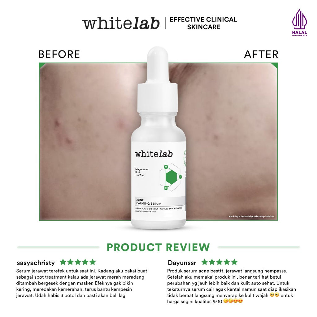 Whitelab Acne Calming Serum - Serum untuk Kulit Jerawat, Bruntusan, dan Berminyak dengan Mugwort, BHA & Tea Tree [BPOM]
