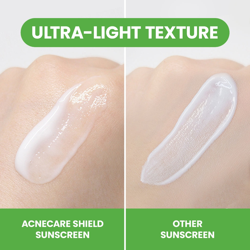 YOU Sunbrella Pro Acnecare Shield Sunscreen SPF 50+ PA++++ Acne Sunscreen Skincare  Collection Sunscreen Acne Prone Skin Melindungi dari Jerawat dan Sinar UV