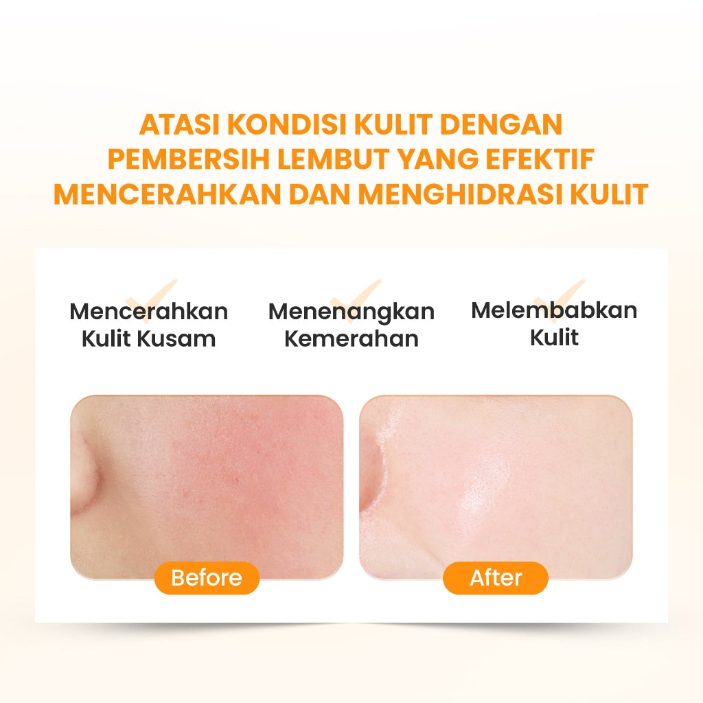 YOU Hy! Amino Glo-Win Brightening Facial Wash Mencerahkan Niacinamide Glowing Skin
