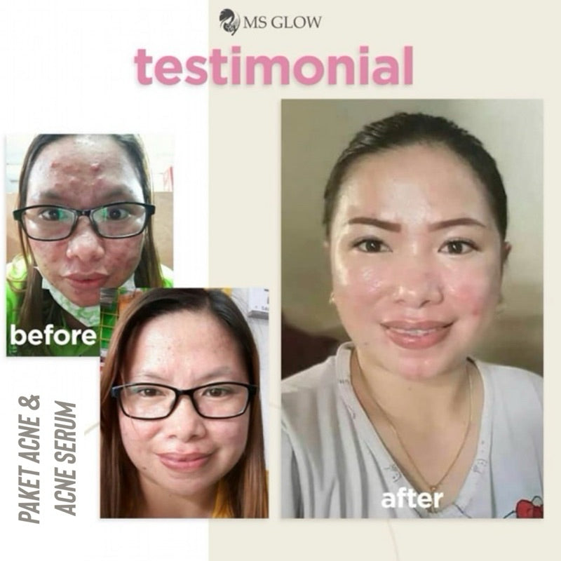 Serum MS glow