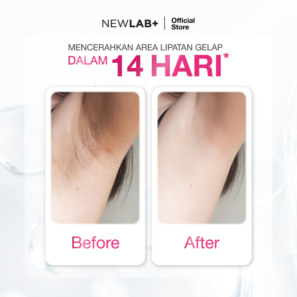 NEWLAB Brightlogy Brightening Serum + AHA Pencerah | Scrub Ketiak | Serum Ketiak |Cream Ketiak | Body Care untuk Memutihkan 30ml