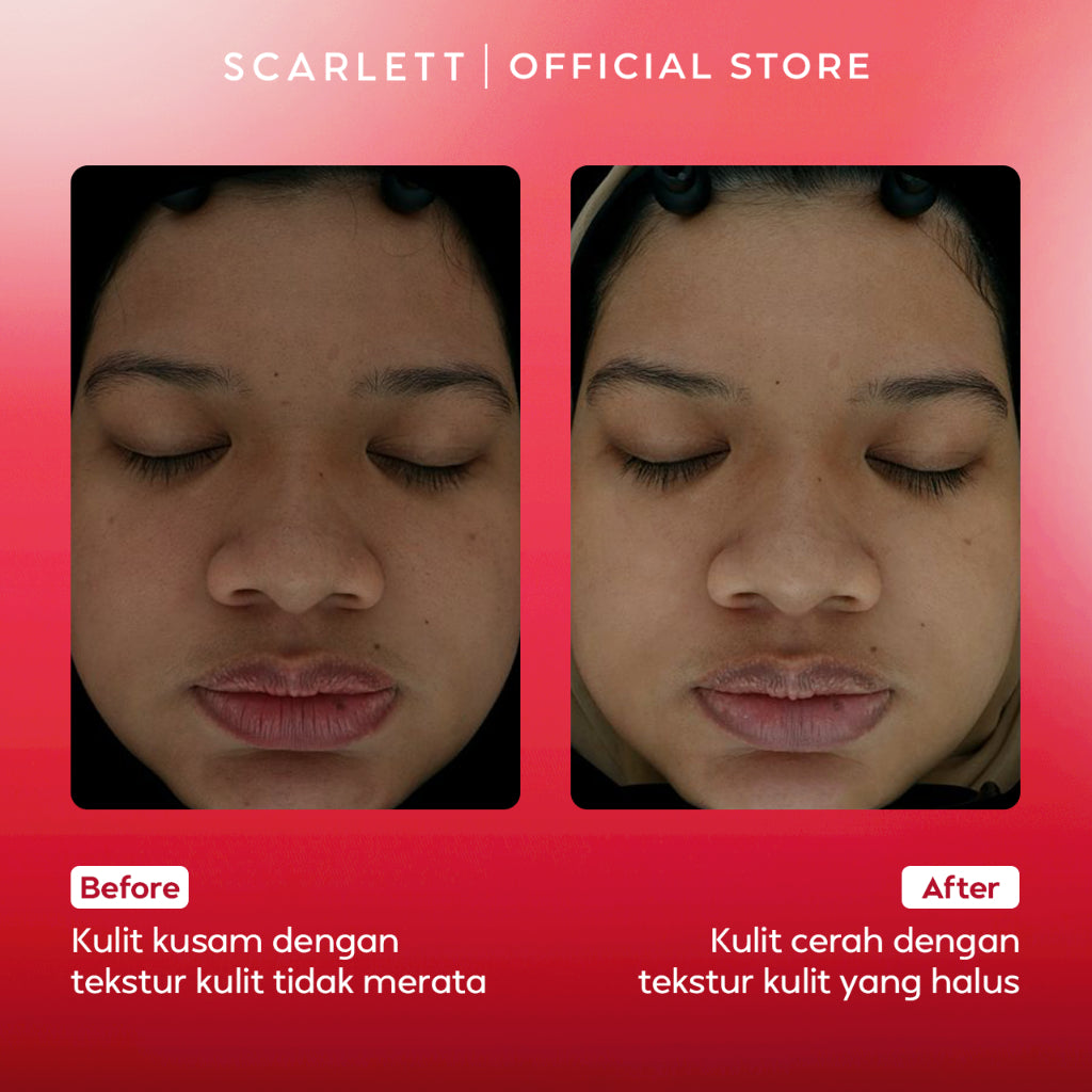 Scarlett Whitening Revive Glow Elixir Red Exfo Intensive Peeling Solution & Ultra Light Daily Sunscreen 50ml