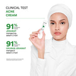 Whitelab Acne Cream - Krim Totol Atasi Jerawat dalam 2 Hari dengan Sulfur, Calamine & Mugwort [BPOM]