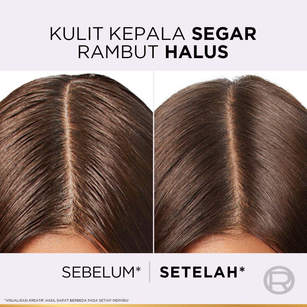 [BARU] L'Oreal Paris Hyaluron Pure 72H Rehydrating Conditioner - Perawatan Rambut Bebas Lepek dan Rambut Halus tahan hingga 72jam -  265ml - Kulit Kepala Berminyak dan Rambut Kering