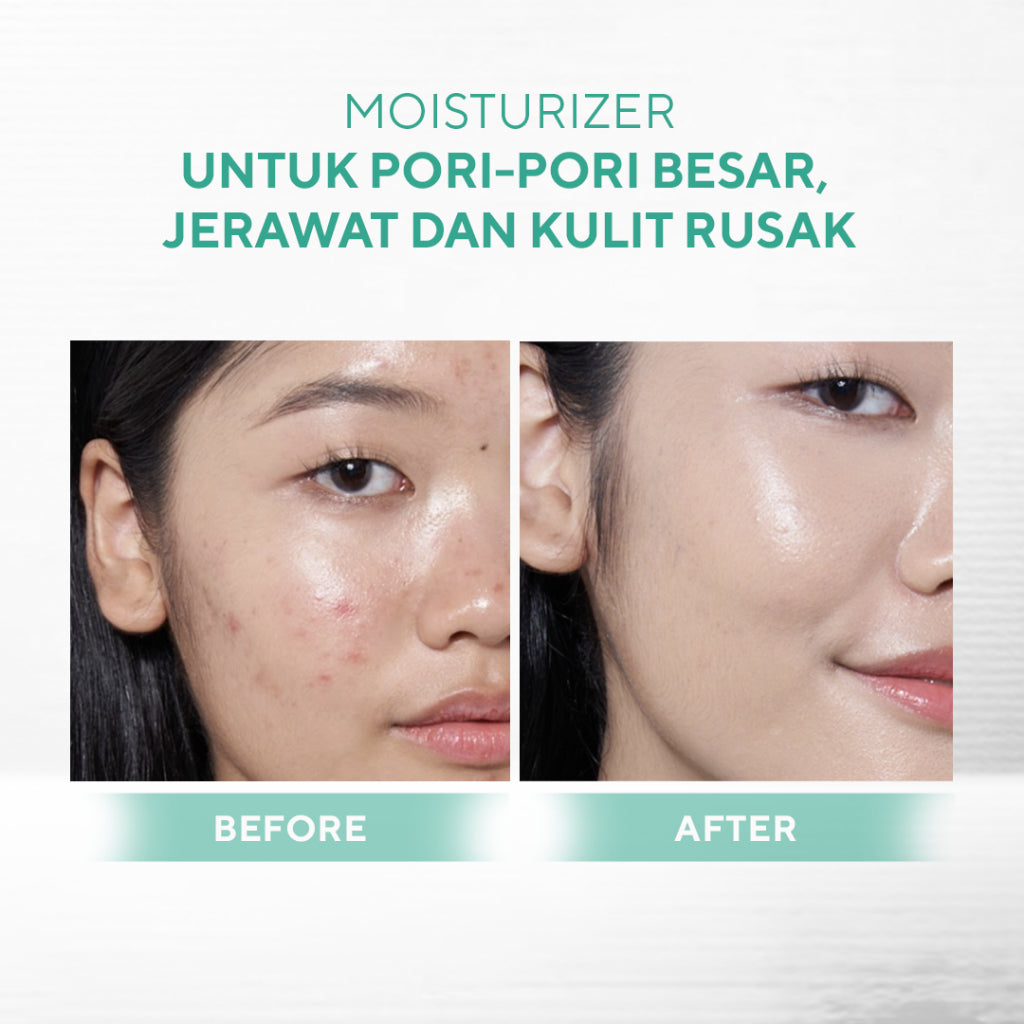 WARDAH Cica Complex + Panthenol Ceramide Calm & Soothe Gel Moisturizer 30 g - Pelembab Gel Ringan yang Meredakan Kemerahan & Kulit Reaktif, Memperbaiki Skin Barrier - Cocok untuk Kulit Berjerawat & Breakout (Calm Acne & Redness) - Skincare