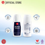 Viva Acne Lotion - 30ml