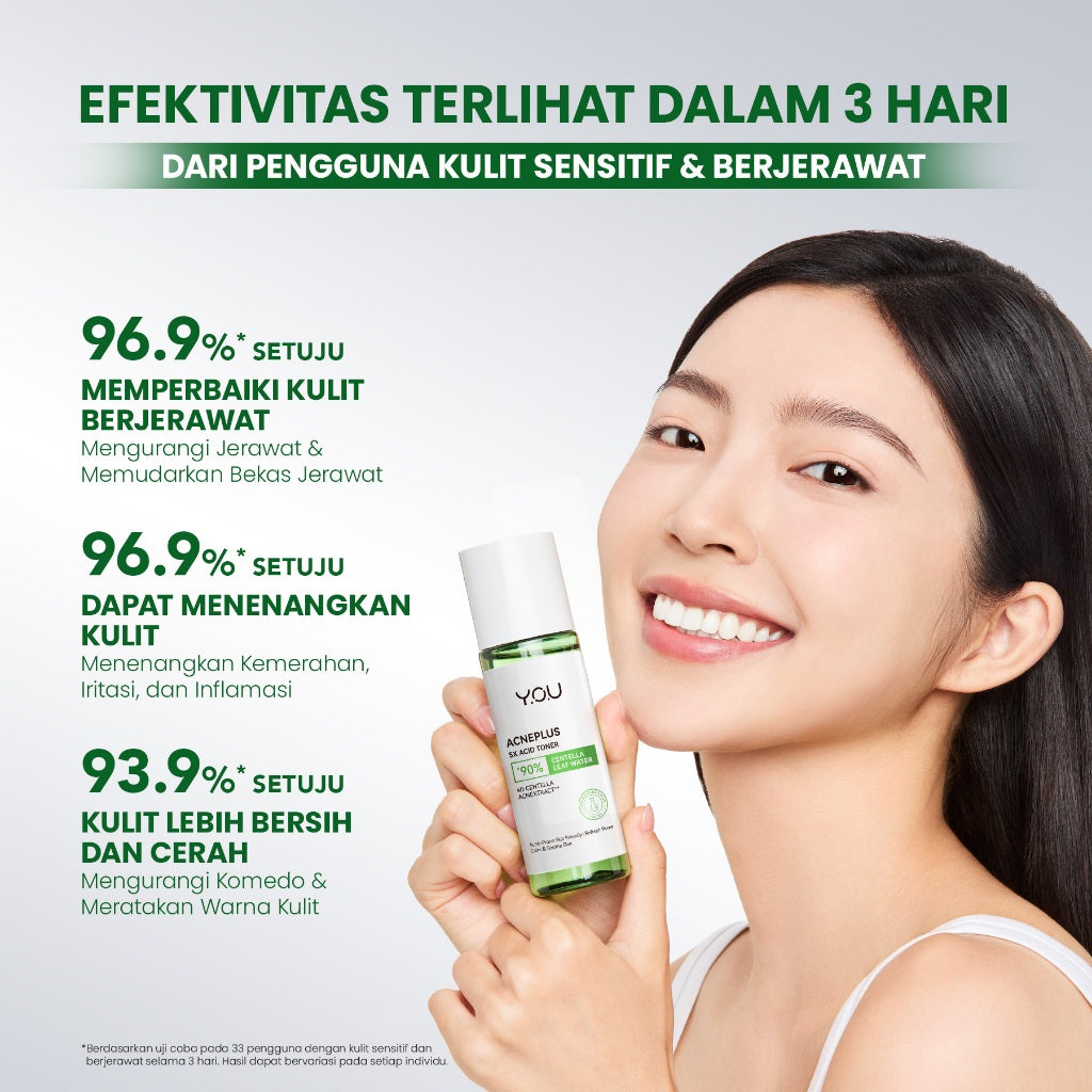 [NEW] YOU AcnePlus 5X Acid Toner Toner Acne Kulit Berminyak Berjerawat Obat Jerawat
