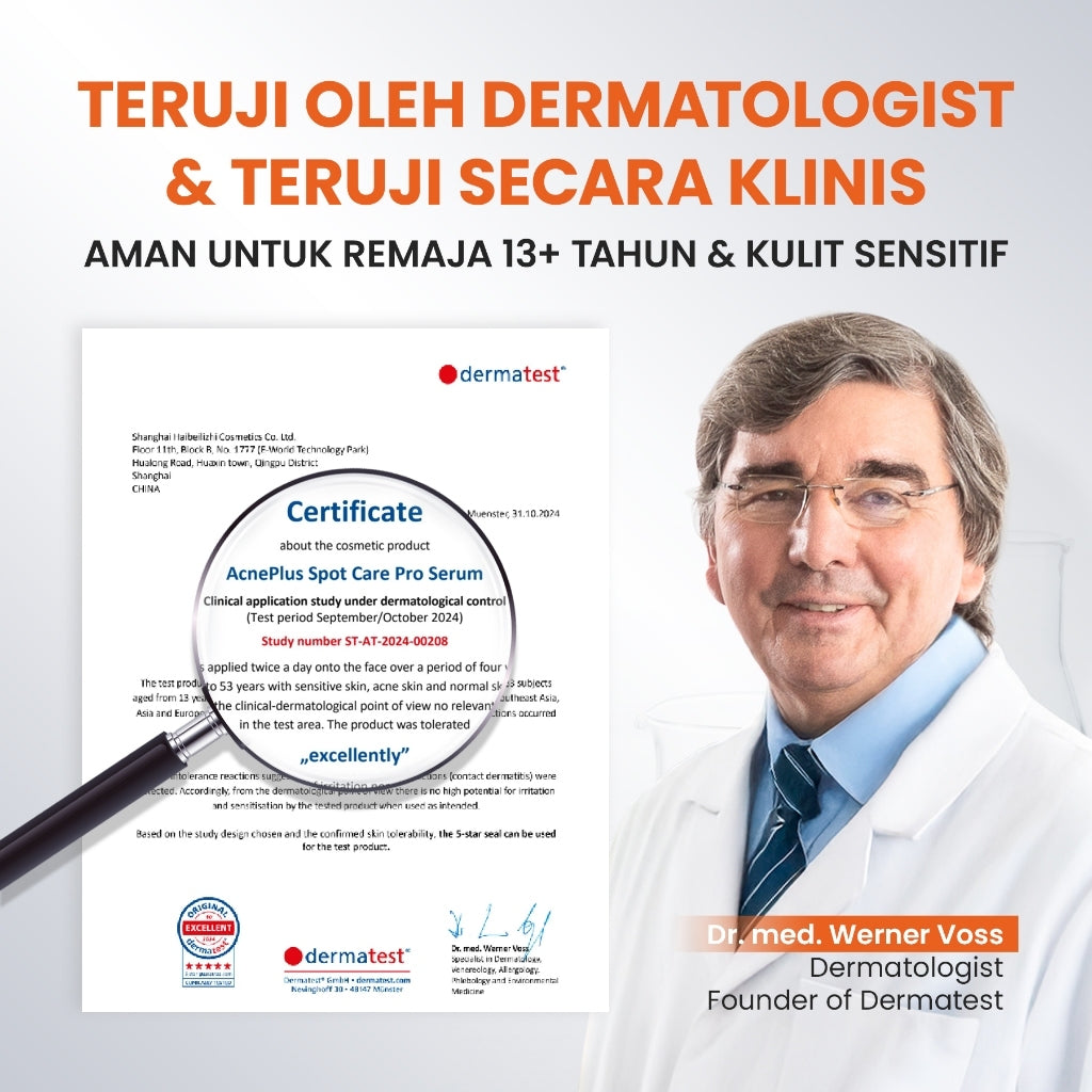 [NEW UPGRADED] YOU AcnePlus Spot Care Pro Serum Obat Totol Jerawat Obat Jerawat Obat Bekas Jerawat