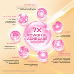 Hanasui Power Acne Serum - Jerawat & Beruntusan Menenangkan & Kurangi Produksi Minyak Salicylic Acid dan Glycolic Acid