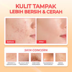 Hanasui Power Peeling Serum -  Eksfoliasi Wajah Mencerahkan, Angkat Sel Kulit Mati Komedo, Kulit Tidak Iritasi Kering
