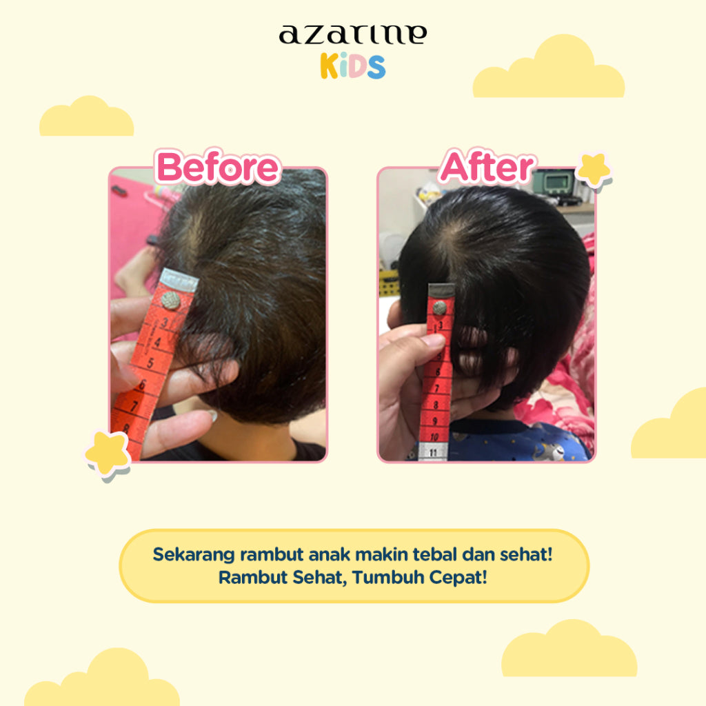 Azarine Kids Hairtopia Nutrition Serum 100ml with 3in1 Benefits Serum Penumbuh Rambut Bayi & Anak PARABEN FREE Tidak Perih di Mata