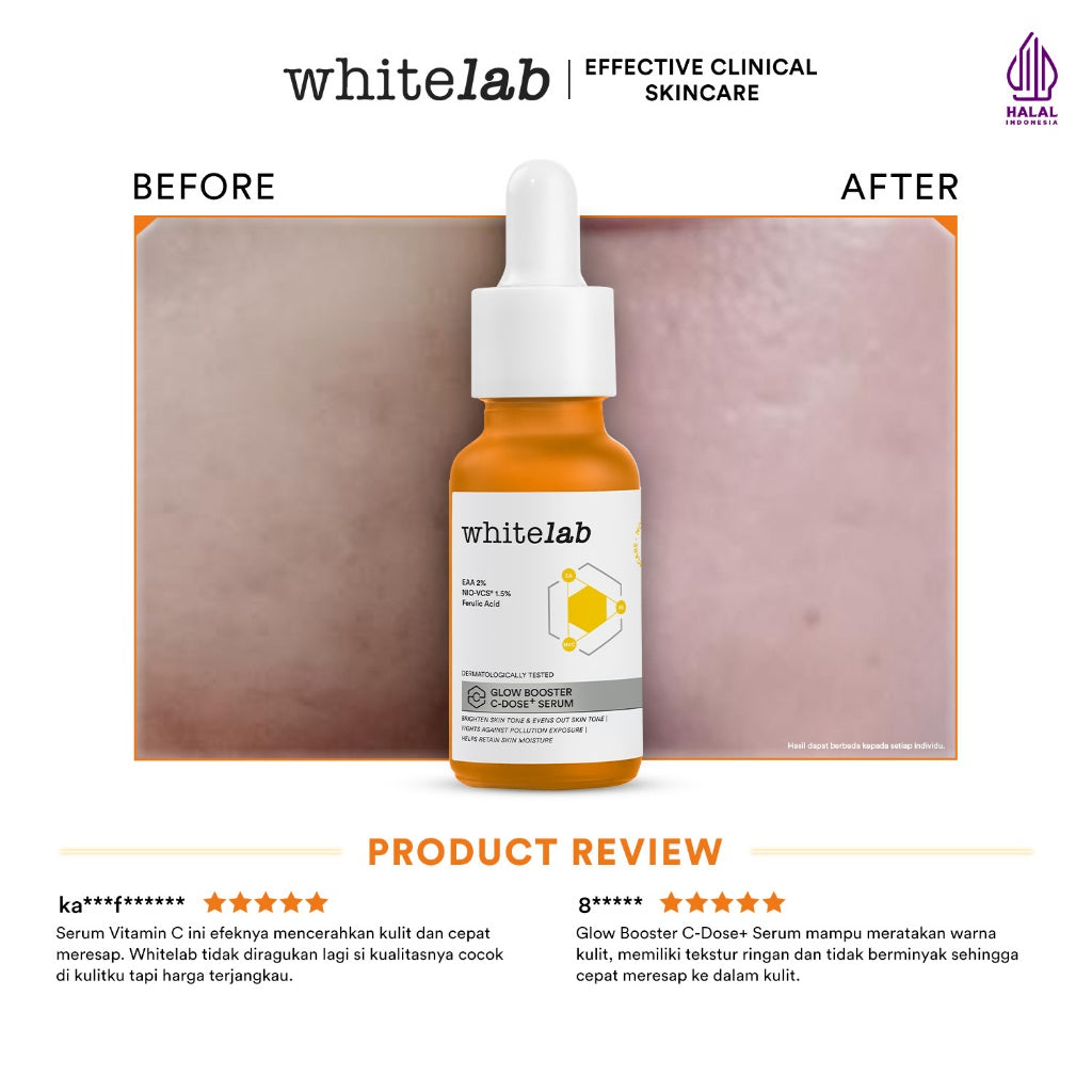 Whitelab Serum Vitamin C Glow Booster - Antioksidan Tinggi untuk Kulit Cerah dan Glowing C-Dose+ dengan NIO-VCS