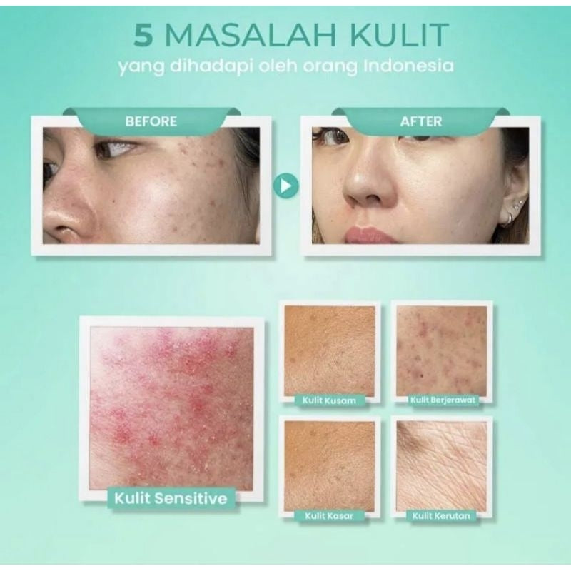Hanasui Ceramide Probiotics Moisturizer Gel Pelembap Wajah 30 g