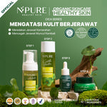 PAKET 4PCS - NPURE Paket Face Wash + Toner + Serum + Moisturizer Cica Acne - Marigold Anti Aging - Noni Sensitive - Licorice Brightening and Glowing Cleanser Mencerahkan Gatal Wajah Treatment Facial Hydrating