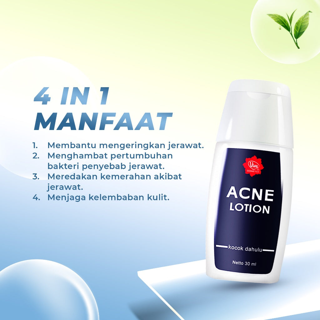 Viva Acne Lotion - 30ml