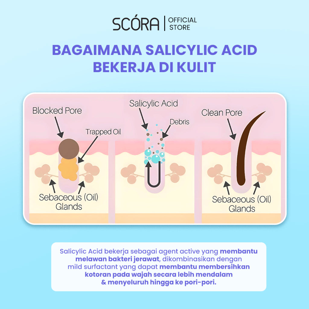 IRIT BEBAS JERAWAT-SCORA Salicylic Acid Gentle Low pH Cleanser Sabun Cuci Muka Oily Acne Prone Skin Friendly [TwinPack 2 Pcs]