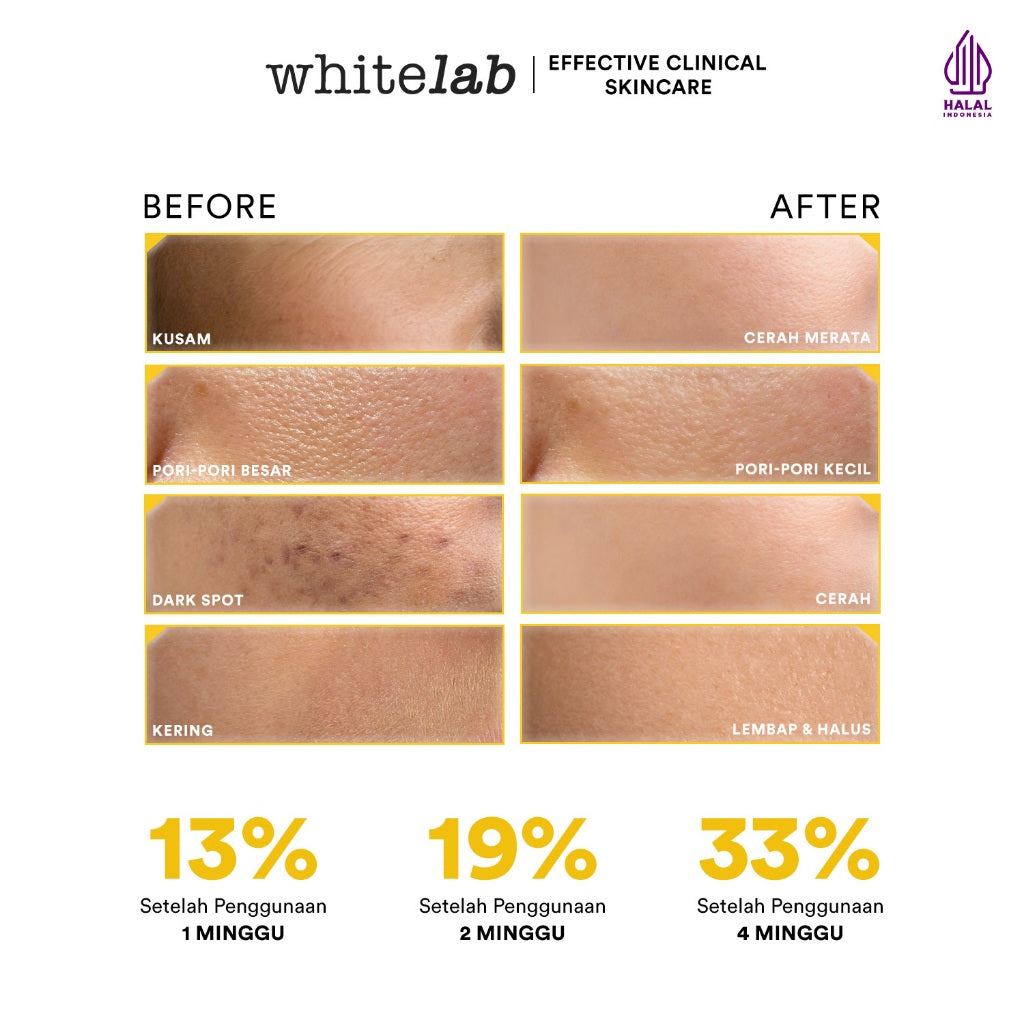 Whitelab Day Cream Brightening  - Pelembap Krim Pagi Pencerah Wajah Untuk Kulit Oily N-Dose+ 2.0