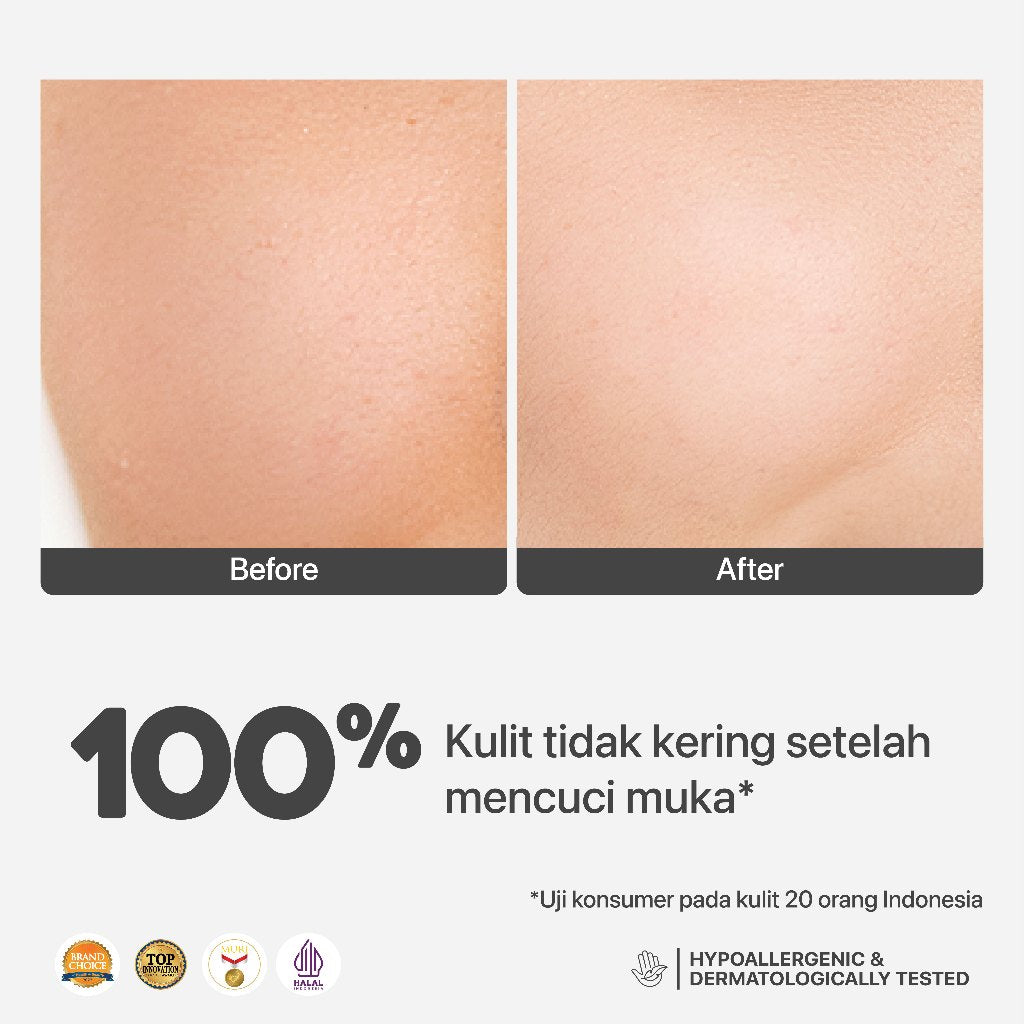 NPURE Cleanser Gel Noni Mini 50ML / Cleanse Me Softly / Gentle Skin Cleanser / Pembersih Wajah Hypoallergenic / Sensitive Approved / Eczema / Semua Jenis Kulit / ph Balance / Travel Size