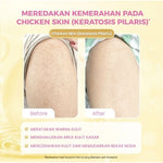 Scarlett Whitening Intense Brightening Serum Tubuh 5% AHA BHA PHA 120 mI