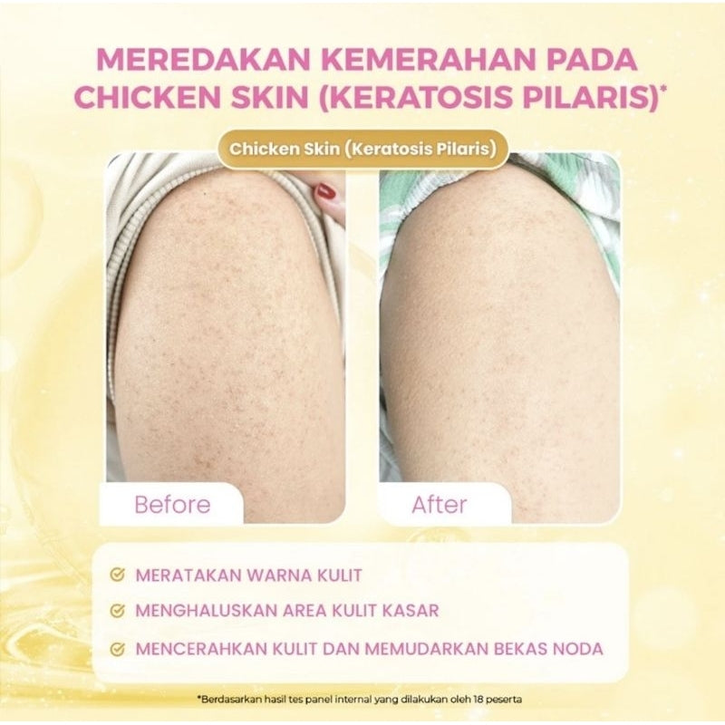 Scarlett Whitening Intense Brightening Serum Tubuh 5% AHA BHA PHA 120 mI