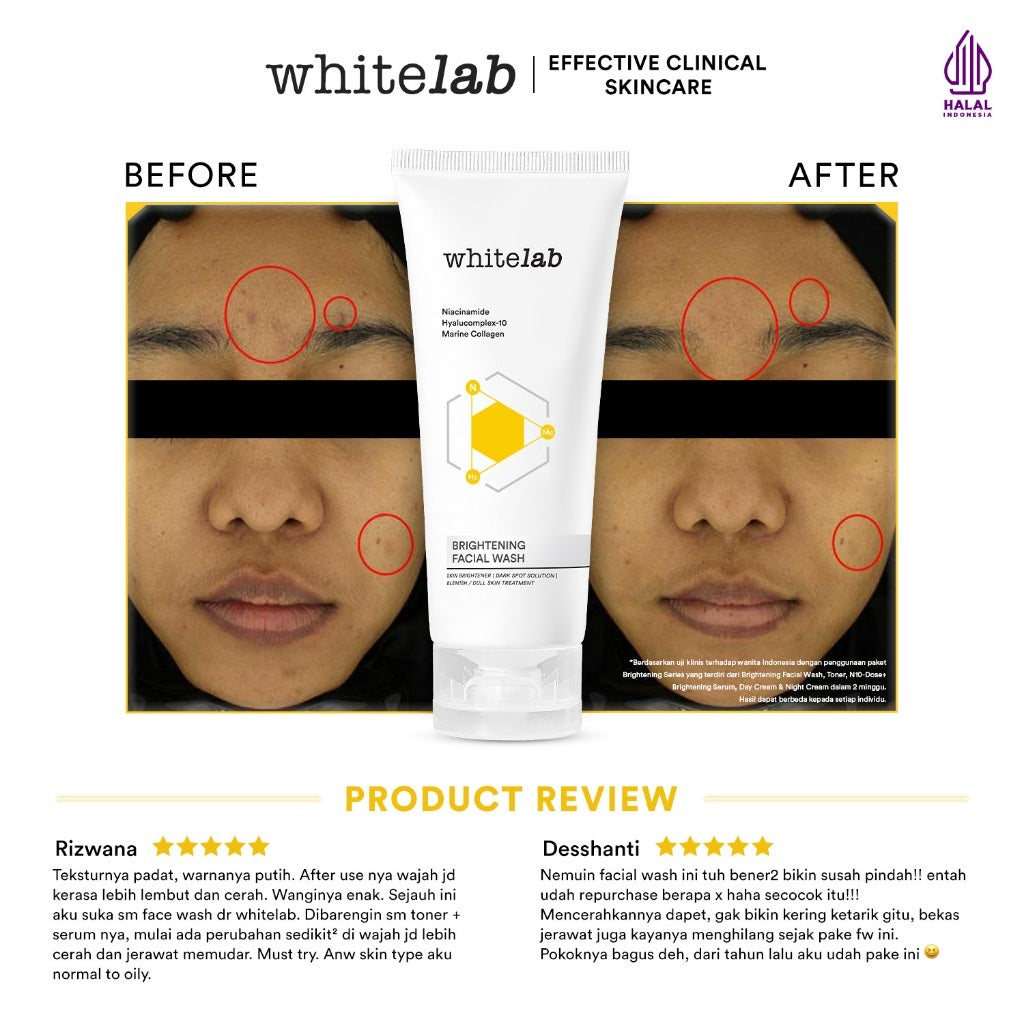 [NEW FORMULA] Whitelab N-Dose+ 2.0 Intensive Brightening Facial - Sabun Pembersih Muka Pencerah Dengan Amino Cleanser Gentle Anti Iritasi (Bpom)