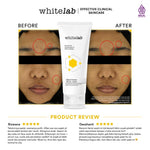 [NEW FORMULA] Whitelab N-Dose+ 2.0 Intensive Brightening Facial - Sabun Pembersih Muka Pencerah Dengan Amino Cleanser Gentle Anti Iritasi (Bpom)