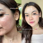 ADLEEVA - (Paket Pemula ISI 4) WHITENING Glow Booster / ACNE Bright Series Basic