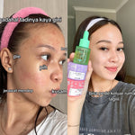 ADLEEVA Paket Hemat Acne Bright Series "COMPLETE" (Paket Isi 5 - Free Acne Blemish Spot)