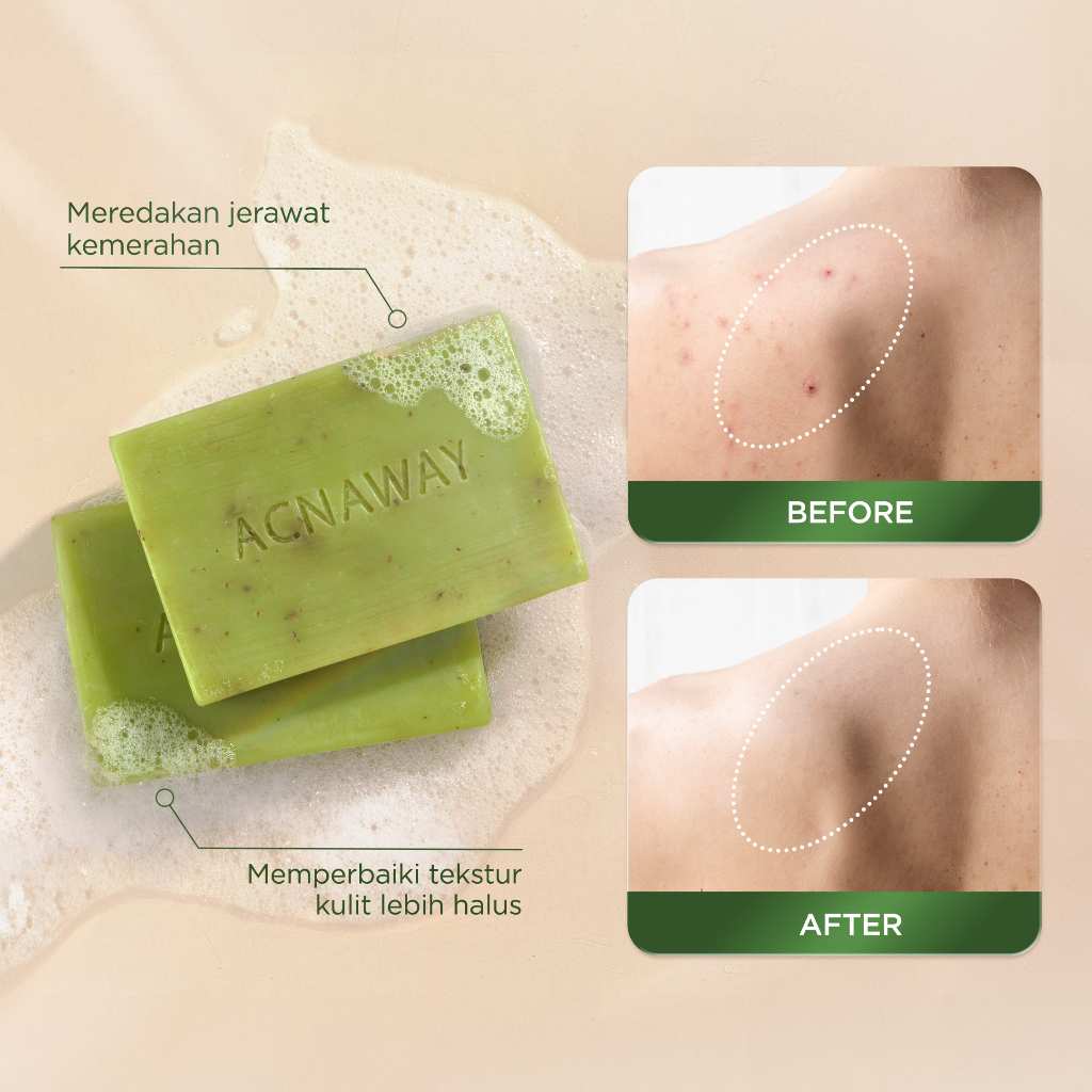 ACNAWAY Mugwort Acne Clear Bar Soap - Sabun Organik Natural Acne Soap untuk Jerawat Badan Tanpa Paraben & Alkohol with Sulfur Calamine Herbal