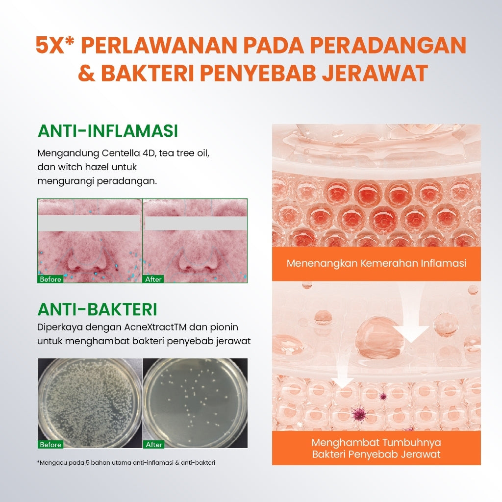 [NEW UPGRADED] YOU AcnePlus Spot Care Pro Serum Obat Totol Jerawat Obat Jerawat Obat Bekas Jerawat