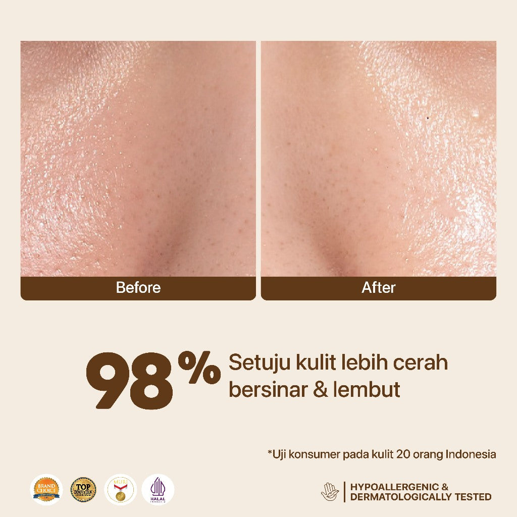 NPURE Licorice Bright & Glow Potion Of Light Face Serum 20ml / Potion of Light / Brightening Serum / Serum Brightening / Wajah Cerah Glowing Flek Hitam / Aman Bumil Busui