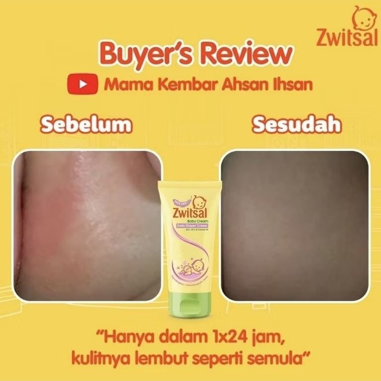 Zwitsal Krim Bayi Anti Ruam Popok Tube 50 mL