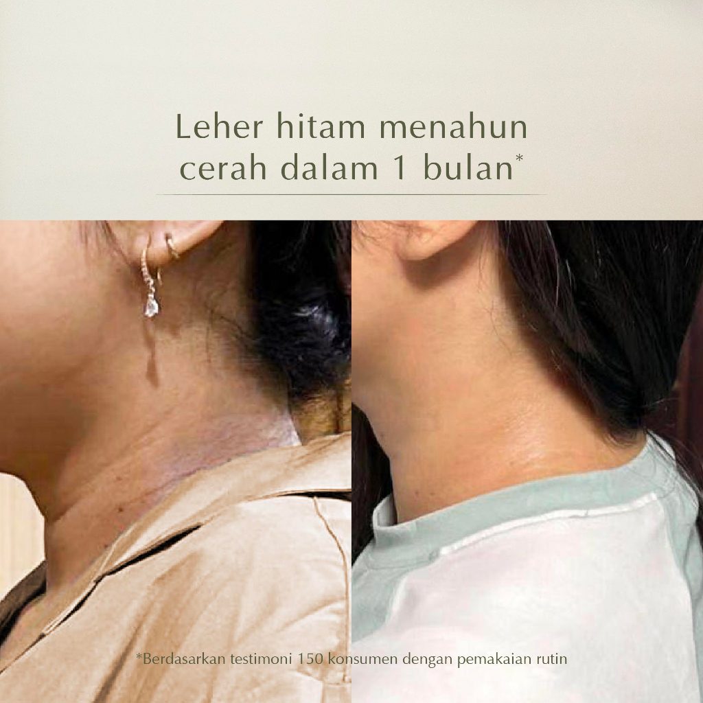 MOSSÈRU 3% Tranexamic Bright Booster Serum | Tranexamic Acid | Niacinamide | Brightening Serum | Menenangkan kulit Kemerahan | Pudarkan Flek & Melasma  | Serum Bekas Jerawat | Menghidrasi kulit | Meratakan warna kulit | Memudarkan bekas je