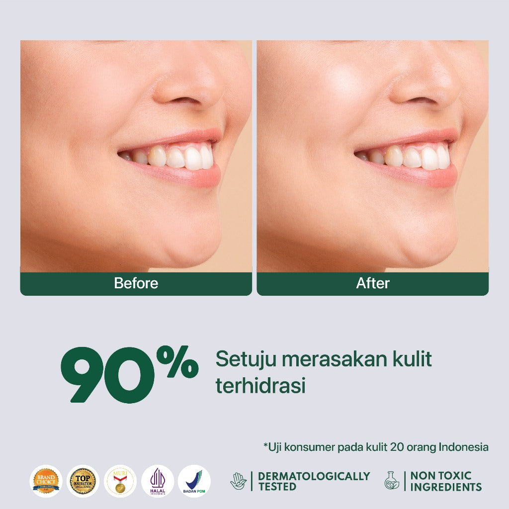 NPURE Sheet Mask Cica / Anti Acne Sheet Mask / Masker Wajah Anti Jerawat
