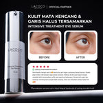 ⁠⁠[Abel Cantika's Picks] Lacoco Intensive Treatment Eye Serum Krim Mata Kerutan Garis Halus The Ori Imploring Beauty Skint