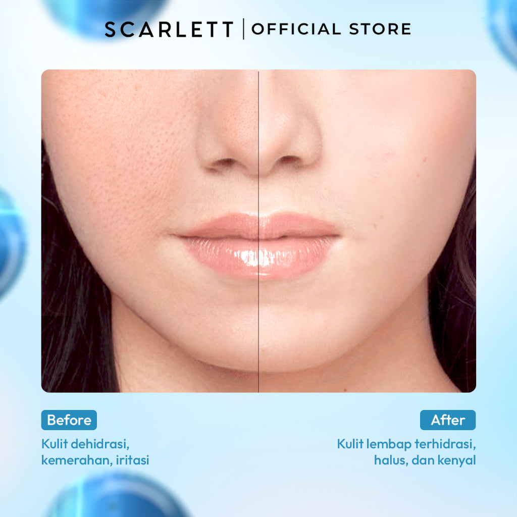 [NEW LAUNCH] Scarlett Blue Hydra Intensive Calming Solution dengan Azulene Allantoin Serum Wajah untuk Menenangkan, Menghidrasi, Kulit Plumpy