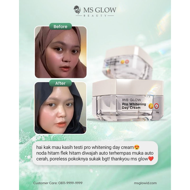 MS GLOW DAY CREAM WHITENING