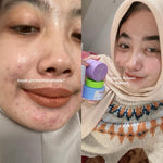 ADLEEVA - BUNDLE Basic Skincare Kit (Isi 3 produk)