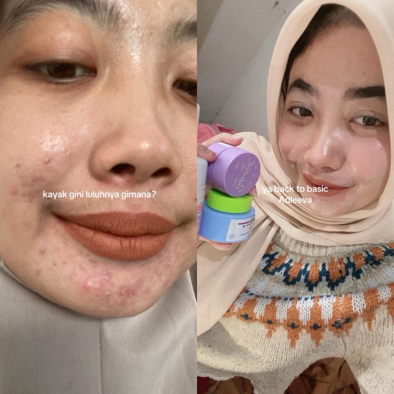 ADLEEVA - BUNDLE Basic Skincare Kit (Isi 3 produk)